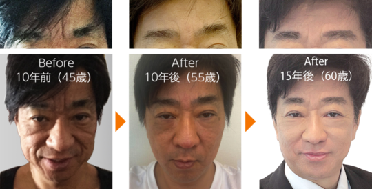 幹細胞治療 - 肌再生医療・幹細胞治療ならフォーシーズンズ肌再生美容